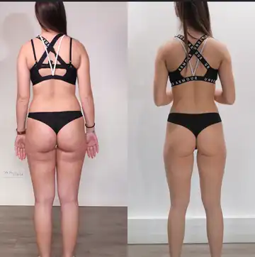 Avant / après : exemple de transformation gain de muscle